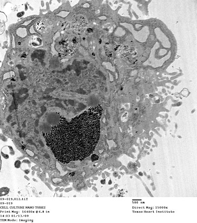 Dark spots are aggregates of gadonanotubes (GNTs) in the cytoplasm of a mesenchymal stem cell. Dark spots are aggregates of gadonanotubes (GNTs) in the cytoplasm of a mesenchymal stem cell.