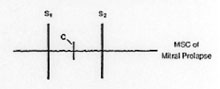 Midsystolic Click of Mitral Prolapse Midsystolic Click of Mitral Prolapse