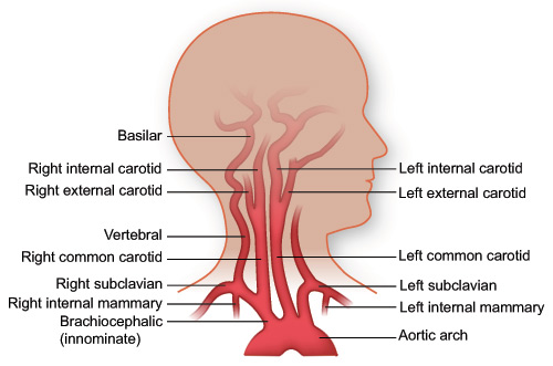 Arteries of the head and upper torso Arteries of the head and upper torso