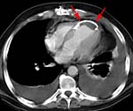 A CT scan A CT scan