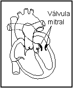 Valvula mitral