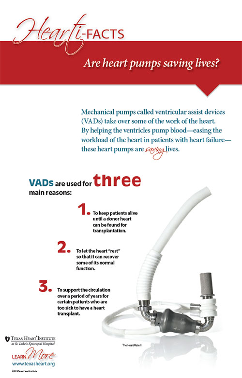 Heart Assist Devices