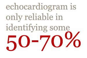 ekg