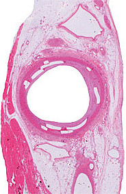 Plastic-HE microscopy image Plastic-HE microscopy image