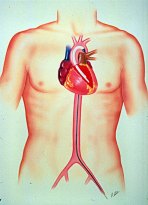 Diagram of the Hemopump cardiac assist pump