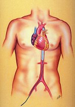 Illustration showing the IABP in a human.