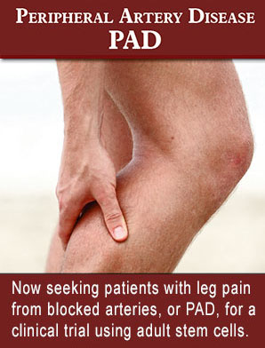 Stem Cell Center screening for clinical study pf patients with PAD Stem Cell Center screening for clinical study pf patients with PAD