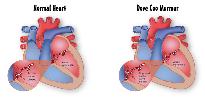 Dove Coo Murmur diagram